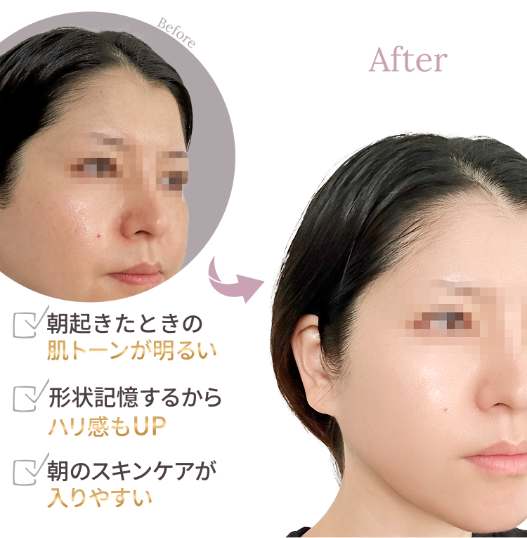 Before After 比較